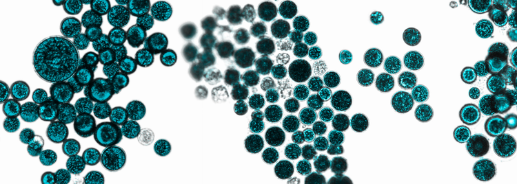 Blog of Introducing Postbiotics — The Newest Biotic for Total Microbiome Support which have image Introducing Postbiotics — The Newest Biotic for Total Microbiome Support