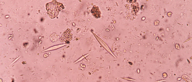 Blog of Gut Parasites: Types, Symptoms, and More which have image parasites under microscope