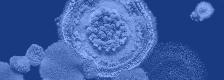 Blog of Understanding Mould Exposure: A Cellular Perspective on Supporting Health During Environmental Exposure which have image Understanding Mould Exposure: A Cellular Perspective on Supporting Health During Environmental Exposure
